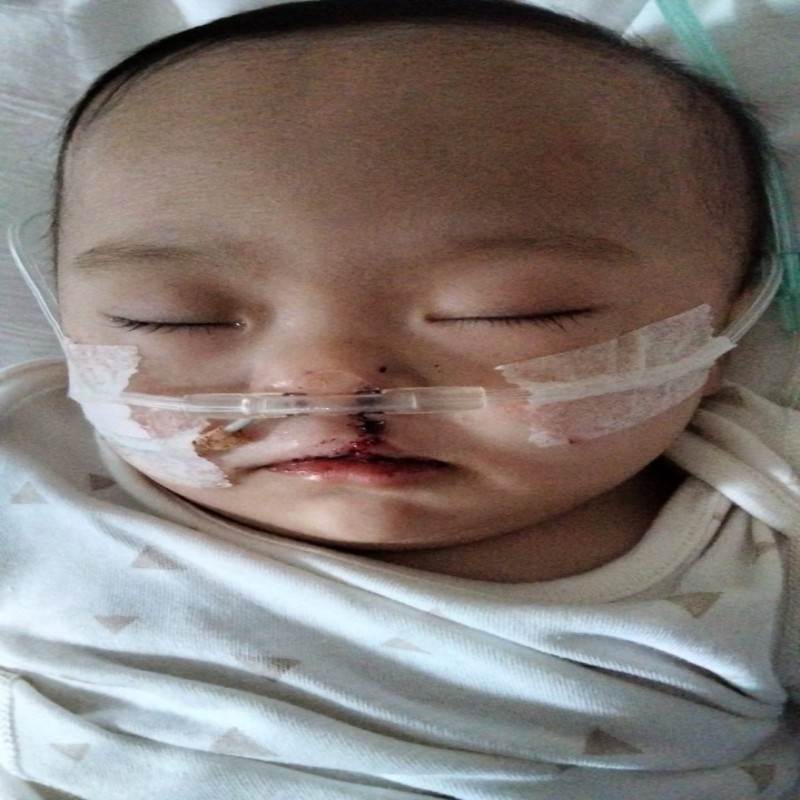 Bayi 1 Tahun Menderita Berbagai Penyakit Dalam Tubuh Mungilnya