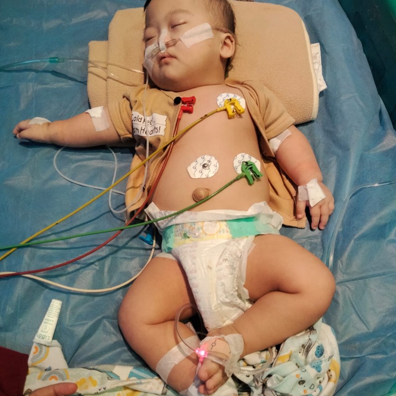 Bayi 1 Tahun Menderita Berbagai Penyakit, Tolong Aydan Untuk Bisa Terus Berobat