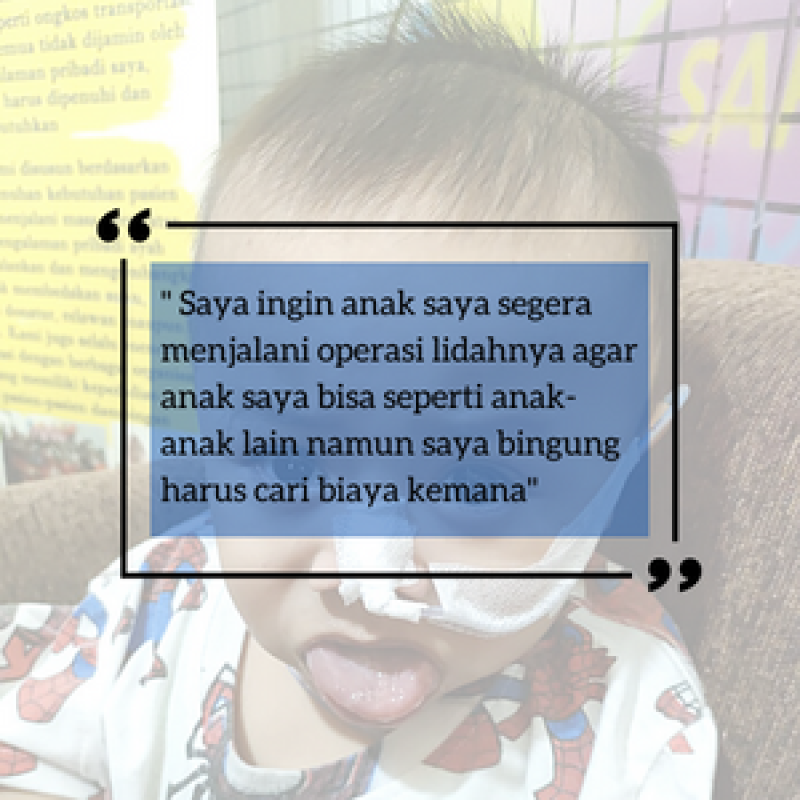 Idap Syndrome Langka, Ilham Harus Segera Menjalani Operasi Lidah