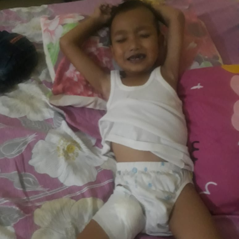 Fadil Asal Aceh Berjuang Sembuh Dari Bocor Jantung