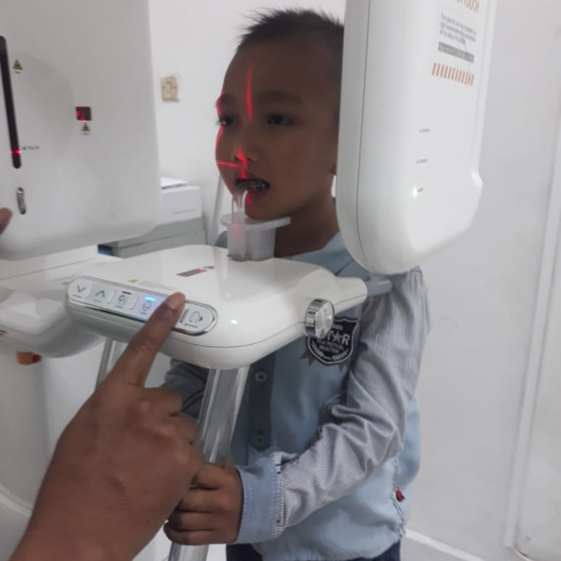 Fadil Asal Aceh Berjuang Sembuh Dari Bocor Jantung