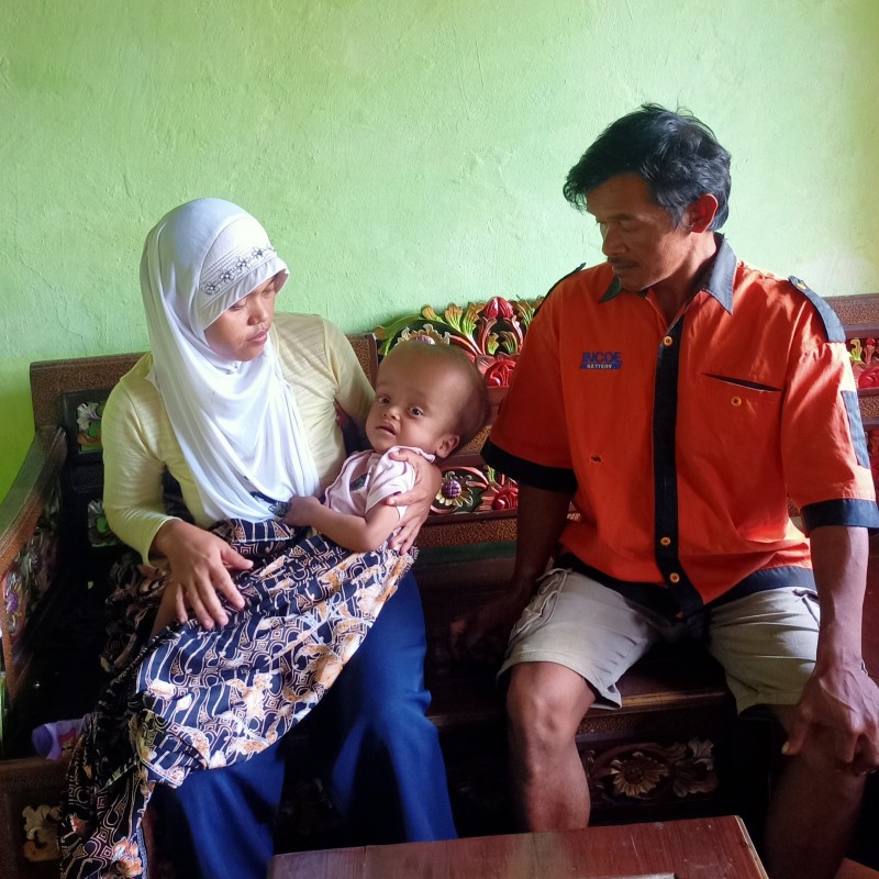 Mengidap Hidrosephalus, Syafiq anak Penambang Pasir Butuh Biaya Perawatan. Ayo Bantu
