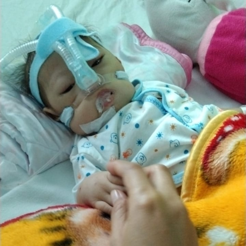 Bayi Shanum Berjuang Sembuh Dari Berbagai Penyakit